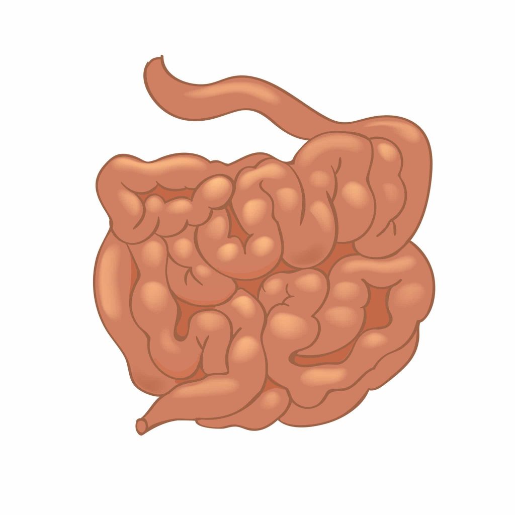 Duodenum Tumor Surgery Duodenal Cancer Dr Joshua Tierney